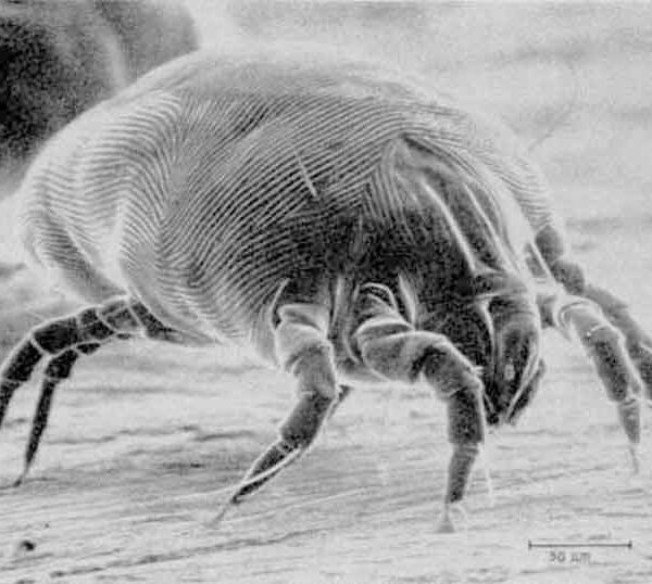 https://pestbugs.org/wp-content/uploads/2018/05/How-to-get-rid-of-dust-mite-kill.jpg